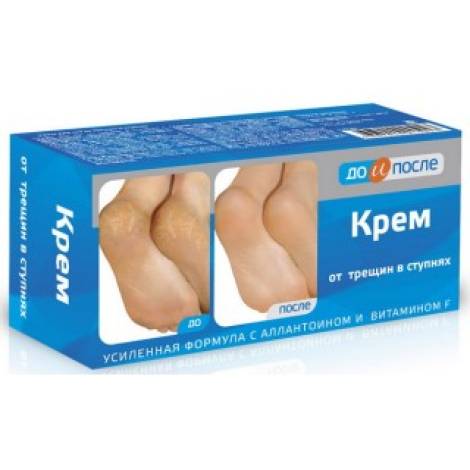 До и после 150,0 От трещин в ступнях крем